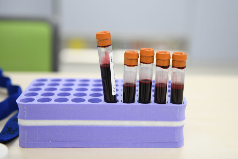 43% of Americans—140 million—have had COVID, CDC estimates