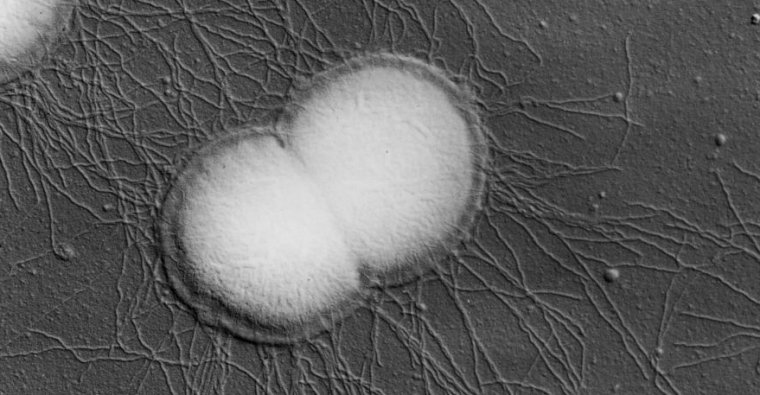 As gonorrhea becomes untreatable, a repurposed vaccine may prevent it