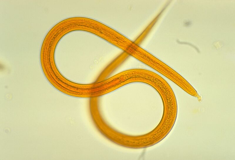 Army of worm larvae hatch from man’s bum, visibly slither under his skin