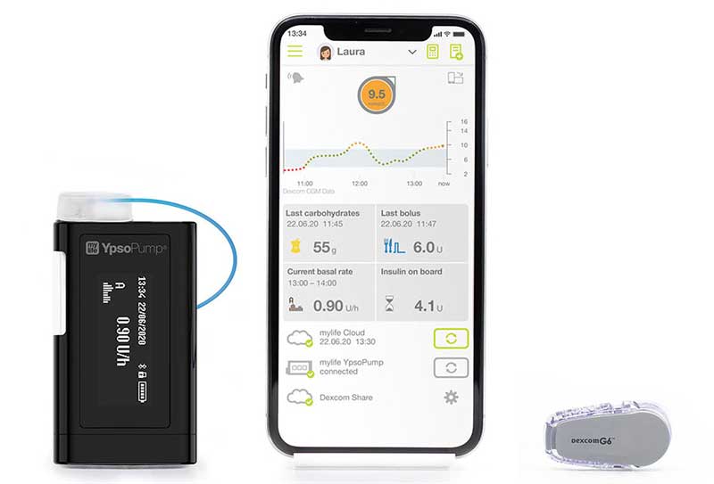 Abbott, CamDiab and Ypsomed Partner Up To Develop Automated Insulin Delivery For People with Diabetes