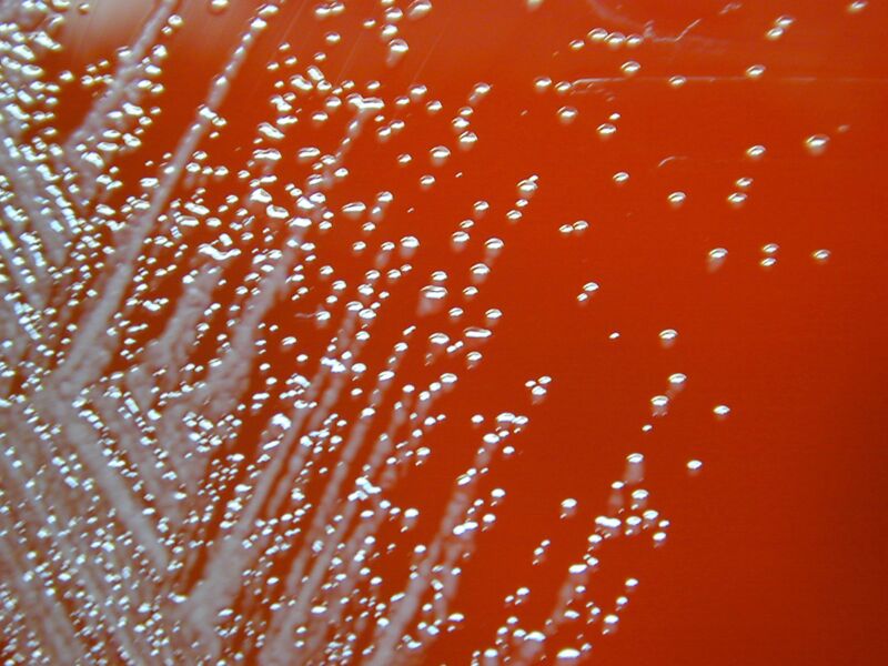 New tragic details of US child who died from tropical bacteria in room spray