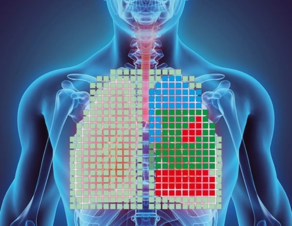 High-Tech Vest Monitors Lung Function #WearableWednesday