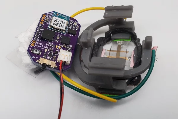 Monitoring Tumor Size with Wearable Device #WearableWednesday