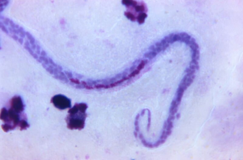 Twirling parasitic worms throw dance party in man’s scrotum
