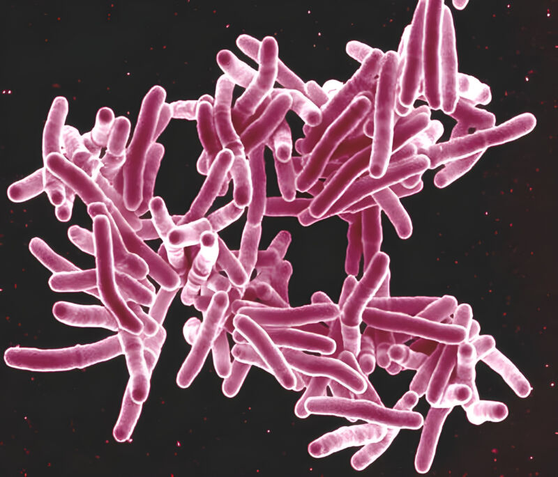 US woman has walked around with untreated TB for over a year, now faces jail
