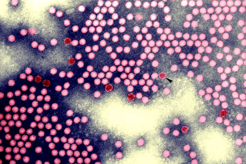 NY officials detect polio again, warn of possible summer wave