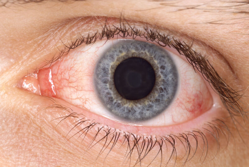 The FDA would like to remind you not to put amniotic fluid in your eyes