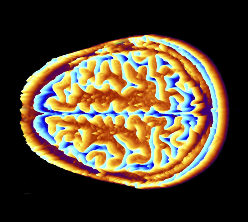 AI plus MRI yields the ability to recognize what the mind is hearing