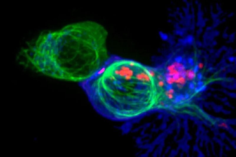 T cells burn out just a few hours after encountering cancer tumors