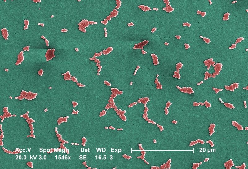 Experimental antibiotic kills deadly superbug, opens whole new class of drugs