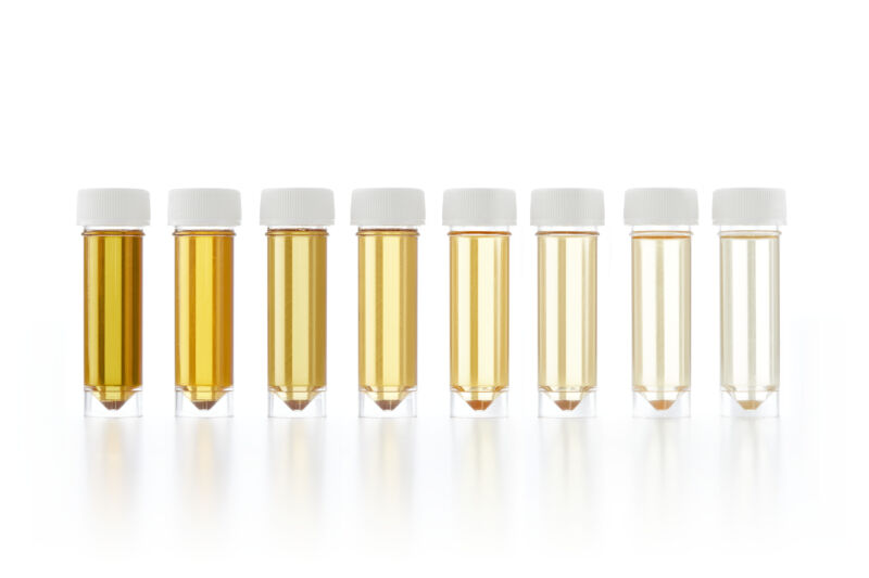 Gotta go? We’ve finally found out what makes urine yellow