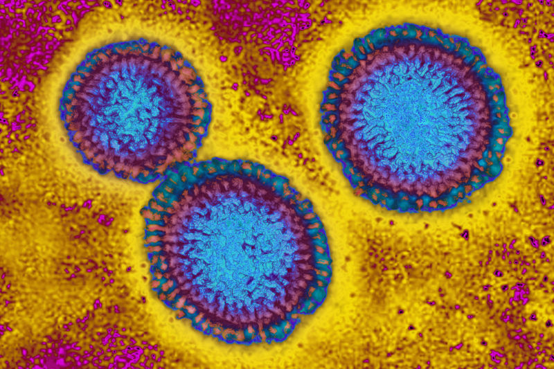 CDC reports dips in flu, COVID-19, and RSV—though levels still very high