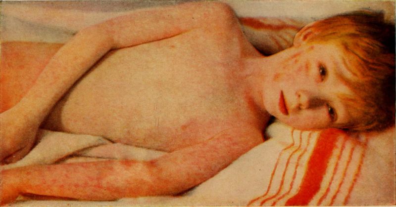 US verges on vaccination tipping point, faces thousands of needless deaths: FDA