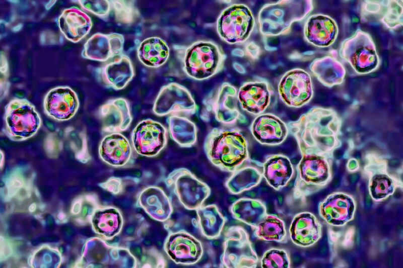 Chicago battles measles with calls for vaccination—in contrast with Florida