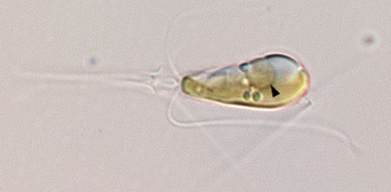 Researchers find a new organelle evolving