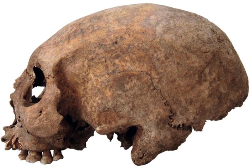 Study: Three skulls of medieval Viking women were deliberately elongated