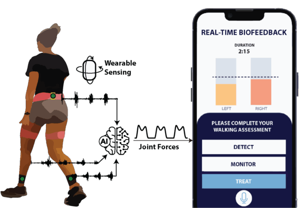 Identifying and Treating Osteoarthritis with Wearables