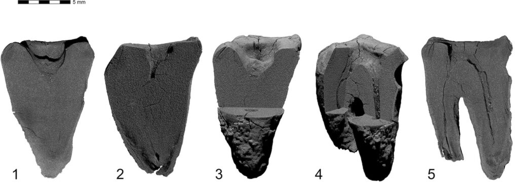 Neanderthal Dentistry Dates Back 60,000 Years