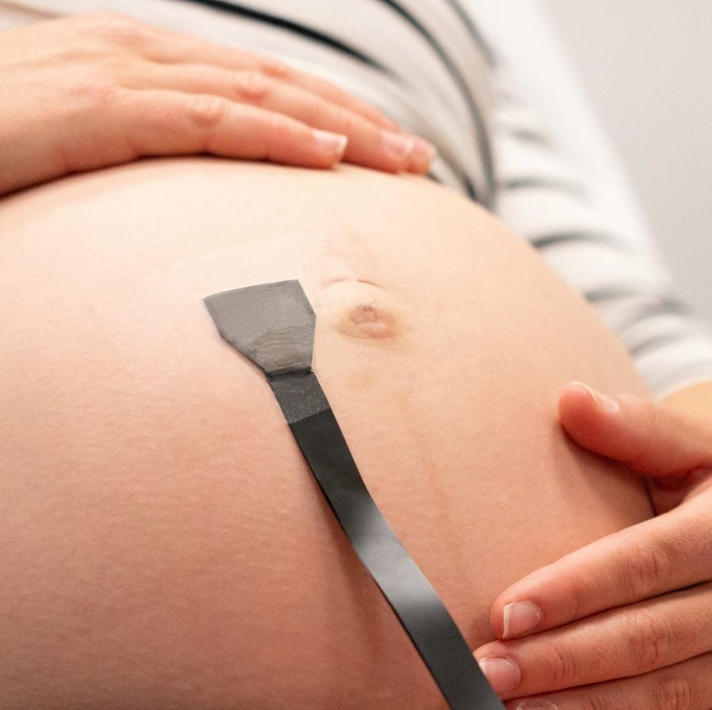 Monitoring High-Risk Pregnancies with a Wearable Ultrasound Patch