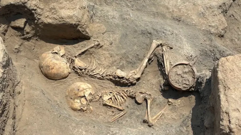 Evidence of Surgery 4,000 Years Ago Uncovered in Central Asia