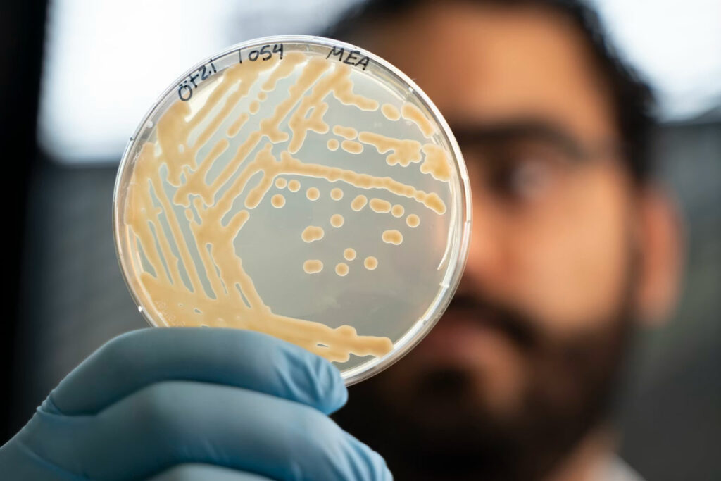 Ancient Yeasts Identified on Ötzi the Iceman