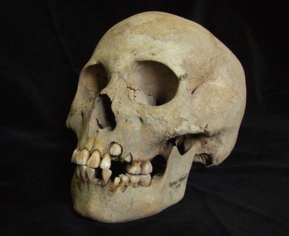 Earliest Plague Outbreak Identified in Siberia