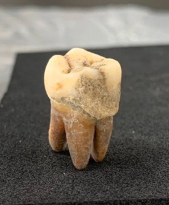 Diets in Premodern Japan Examined Through Dental Calculus