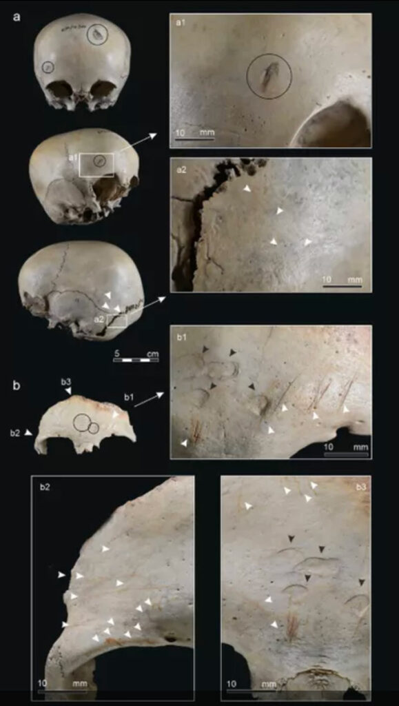 Neolithic Bones From Spain Show Evidence of Cannibalism