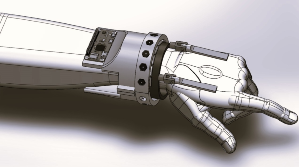 Controlling Tremors with Wearables #WearableWednesday