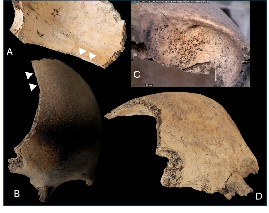 Scandinavian Domestic Burials Studied